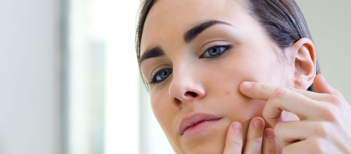 Acne gezichtsbehandeling